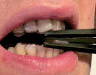 Maultrommel Zahnschutz 3
